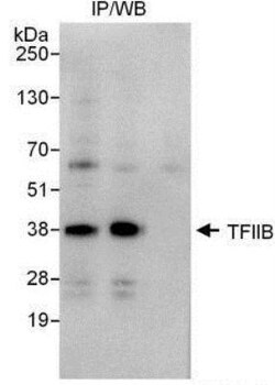 TFIIB Antibody, Novus Biologicals 0.1mg; Unlabeled:Antibodies, Polyclonal