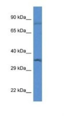 TFIIB Antibody, Novus Biologicals:Antibodies:Primary Antibodies