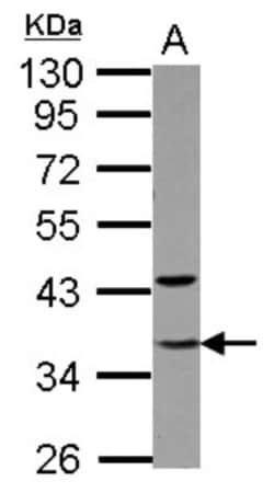 TFIIE beta Antibody, Novus Biologicals 0.1mL; Unlabeled:Antibodies, Polyclonal
