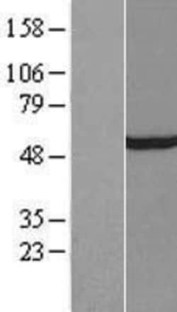 Novus Biologicals&trade;&nbsp;TFIIE-alpha Overexpression Lysate