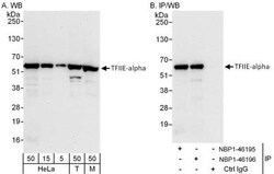 TFIIE-alpha Antibody, Novus Biologicals 0.1mL; Unlabeled:Antibodies, Polyclonal