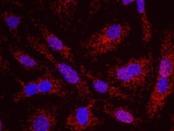 TFIIIC Antibody, Novus Biologicals 0.1mg; Unlabeled:Antibodies, Polyclonal