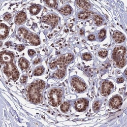 TFIIS Antibody, Novus Biologicals 0.1mL; Unlabeled:Antibodies, Polyclonal