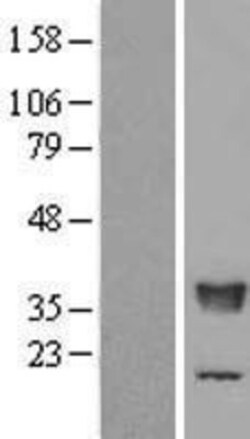 Novus Biologicals&trade;&nbsp;TFIIS Overexpression Lysate