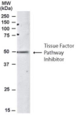 TFPI Antibody, Novus Biologicals 0.1mg; Unlabeled:Antibodies, Polyclonal