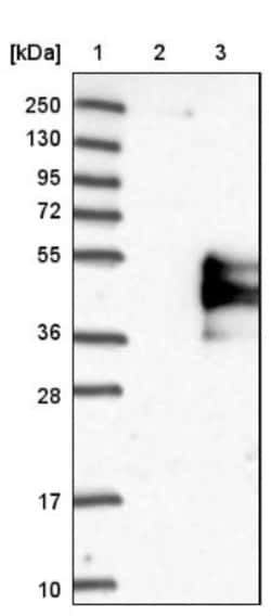 TFPI Antibody, Novus Biologicals 0.1mL; Unlabeled:Antibodies, Polyclonal