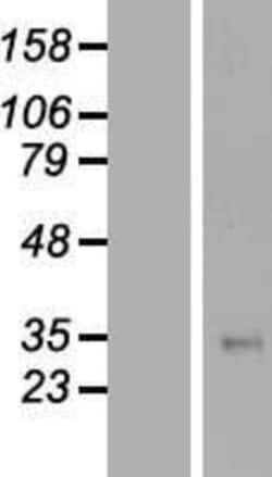 Novus Biologicals™ TFPI Overexpression Lysate