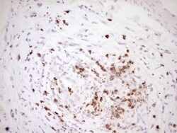 TFPI Antibody (OTI5H5), Novus Biologicals 0.1mL; Unlabeled:Antibodies,