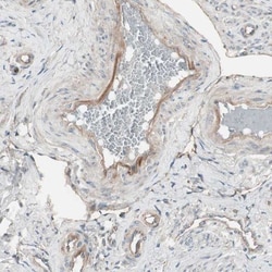 TFPI Antibody, Novus Biologicals 0.1mL; Unlabeled:Antibodies, Polyclonal