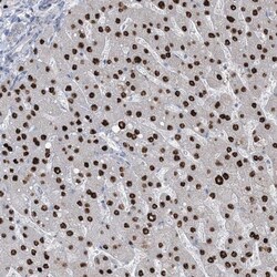 TFPT Antibody, Novus Biologicals 0.1mL; Unlabeled:Antibodies, Polyclonal