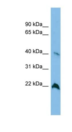 TGDS Antibody, Novus Biologicals:Antibodies:Primary Antibodies