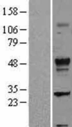 Novus Biologicals™ TGF-beta 2 Overexpression Lysate