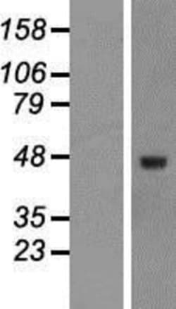Novus Biologicals&trade;&nbsp;TGF-beta 3 Overexpression Lysate