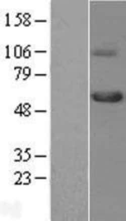 Novus Biologicals&trade;&nbsp;TGF-beta RI/ALK-5 Overexpression Lysate