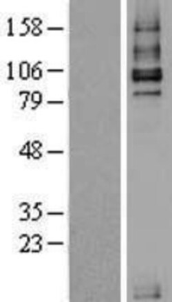 Novus Biologicals™ TGF-beta RIII Overexpression Lysate