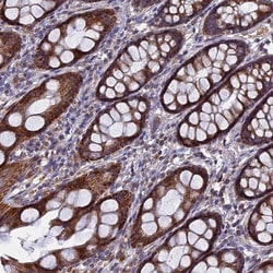 TGF-alpha Antibody, Novus Biologicals 0.1mL; Unlabeled:Antibodies, Polyclonal