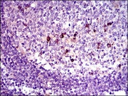 LAP (TGF-beta 1) Antibody (7F6) - BSA Free, Novus Biologicals 0.1mL; Unlabeled:Antibodies,