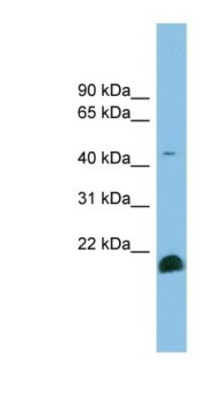 TGF-beta 2 Antibody, Novus Biologicals 0.05mg; Unlabeled:Antibodies, Polyclonal