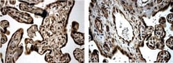 TGF-beta RIII Antibody (MM0057-5G9) - Azide and BSA Free, Novus Biologicals:Antibodies:Primary