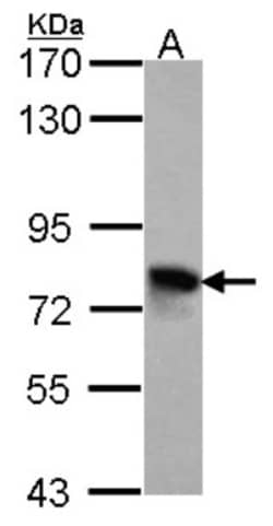 Beta Ig-h3/TGFBI Antibody, Novus Biologicals 0.1mL; Unlabeled:Antibodies,