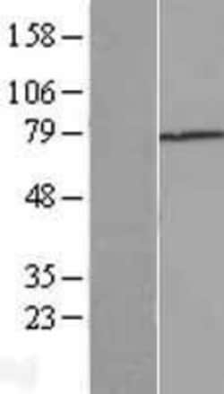 Novus Biologicals™ Beta Ig-h3/TGFBI Overexpression Lysate