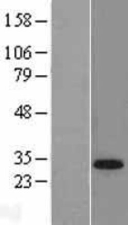 Novus Biologicals™ TGIF1 Overexpression Lysate