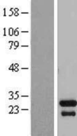 Novus Biologicals™ TGIF2LX Overexpression Lysate