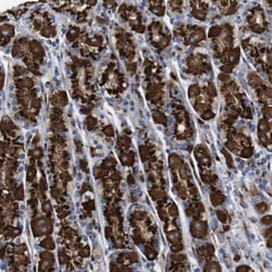 TGN46 Antibody, Novus Biologicals 0.1mL; Unlabeled:Antibodies, Polyclonal