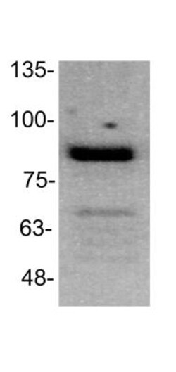 TGN46 Antibody, Novus Biologicals 0.1mL; Unlabeled:Antibodies, Polyclonal