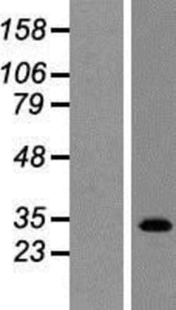 Novus Biologicals&trade;&nbsp;TGR5/GPBAR1 Overexpression Lysate