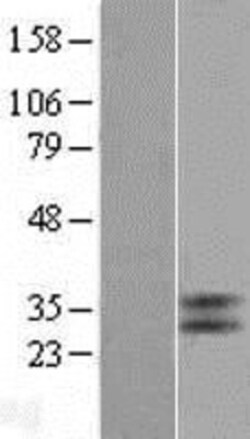 Novus Biologicals&trade;&nbsp;TGR5/GPBAR1 Overexpression Lysate