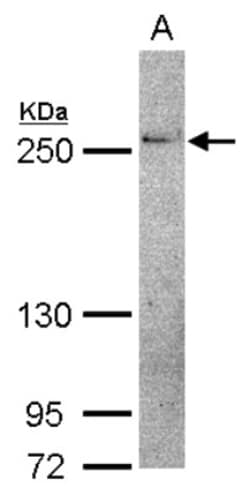 THADA Antibody, Novus Biologicals 0.1mL; Unlabeled:Antibodies, Polyclonal