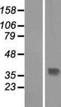 Novus Biologicals&trade;&nbsp;THAP10 Overexpression Lysate