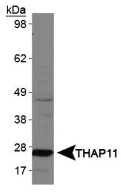 THAP11 Antibody, Novus Biologicals 0.025mL; Unlabeled:Antibodies, Polyclonal