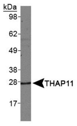 THAP11 Antibody, Novus Biologicals 0.025mL; Unlabeled:Antibodies, Polyclonal