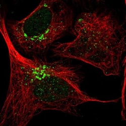 THAP2 Antibody, Novus Biologicals:Antibodies:Primary Antibodies