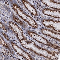 THAP2 Antibody, Novus Biologicals:Antibodies:Primary Antibodies