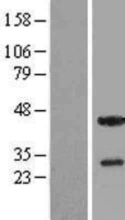 Novus Biologicals&trade;&nbsp;THAP5 Overexpression Lysate