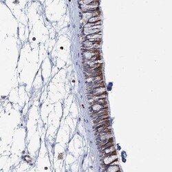 THAP6 Antibody, Novus Biologicals:Antibodies:Primary Antibodies