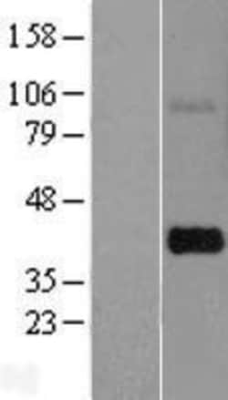 Novus Biologicals™ THAP7 Overexpression Lysate