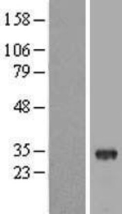 Novus Biologicals™ THAP8 Overexpression Lysate
