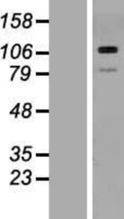 Novus Biologicals&trade;&nbsp;Thrombospondin-3 Overexpression Lysate
