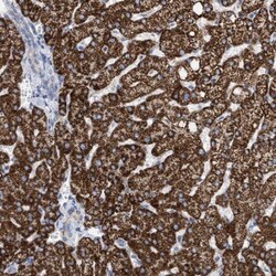 THEM2 Antibody, Novus Biologicals 0.1mL; Unlabeled:Antibodies, Polyclonal