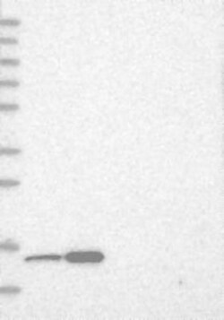 THEM2 Antibody, Novus Biologicals 0.1mL; Unlabeled:Antibodies, Polyclonal