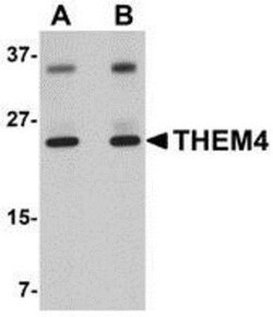 THEM4 Antibody - BSA Free, Novus Biologicals 0.025 mg, Unconjugated:Antibodies,