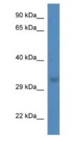 THG1L Antibody, Novus Biologicals:Antibodies:Primary Antibodies