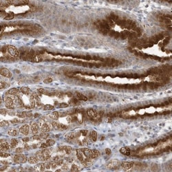 THG1L Antibody, Novus Biologicals:Antibodies:Primary Antibodies