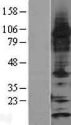 Novus Biologicals&trade;&nbsp;Thioredoxin-2 Overexpression Lysate