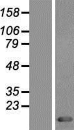 Novus Biologicals™ Thioredoxin-1 Overexpression Lysate