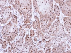 Thioredoxin Reductase 1/TRXR1 Antibody, Novus Biologicals 0.1mL; Unlabeled:Antibodies,